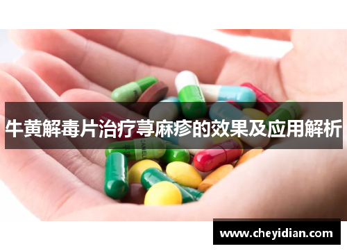 牛黄解毒片治疗荨麻疹的效果及应用解析 牛黄解毒片治疗荨麻疹的效果及应用解析